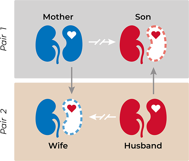 Graphic illustrating paired kidney exchange
